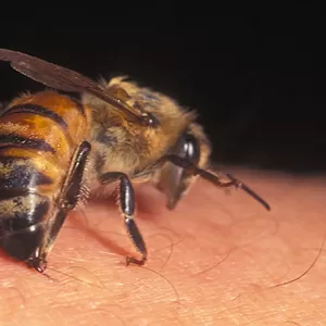 Лечение пчелами протрузии в Алматы