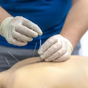Курс по акупунктуре для врачей: группы до 3 человек 
