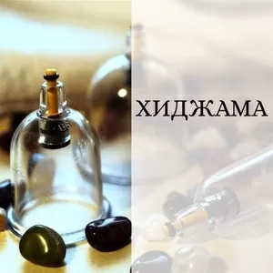 Хиджама без навязывания лишних услуг