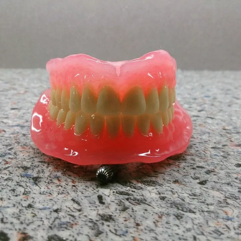 Зубные протезы 2