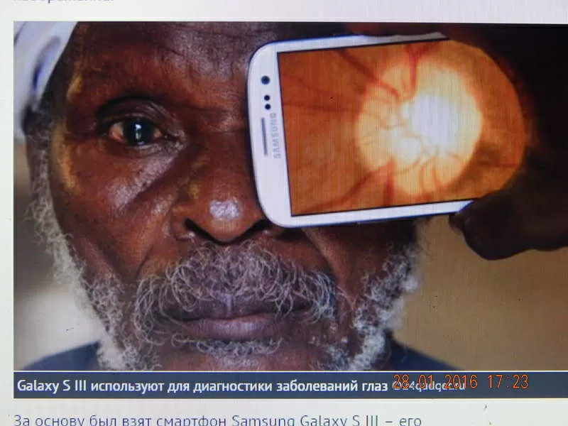 смартфон-офтальмолог