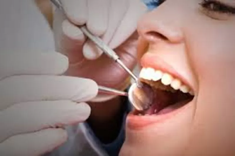 лечение зубов,  кариес , пломба, протезирования зубов 4