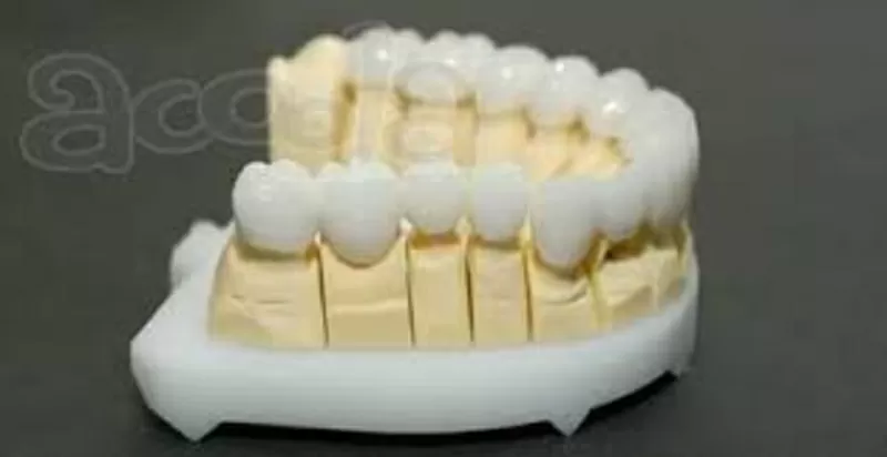 лечение зубов,  кариес , пломба, протезирования зубов 2