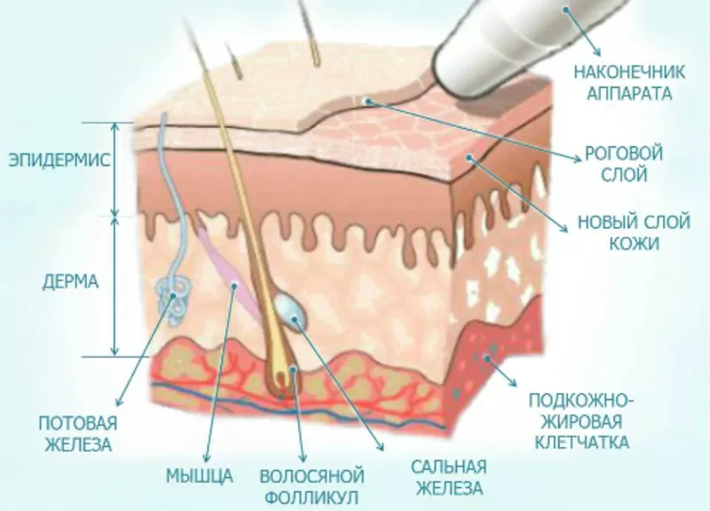 Врач-косметолог с высшим медиц-м обра-нием МахмудоваД Тел: 87017831918 11