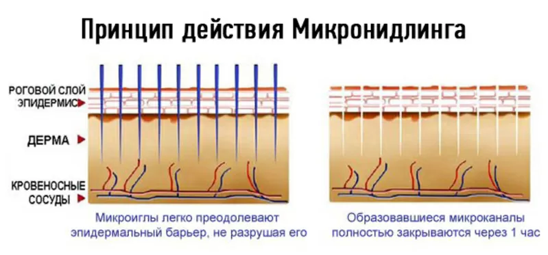 Врач-косметолог с высшим медиц-м обра-нием МахмудоваД Тел: 87017831918 12