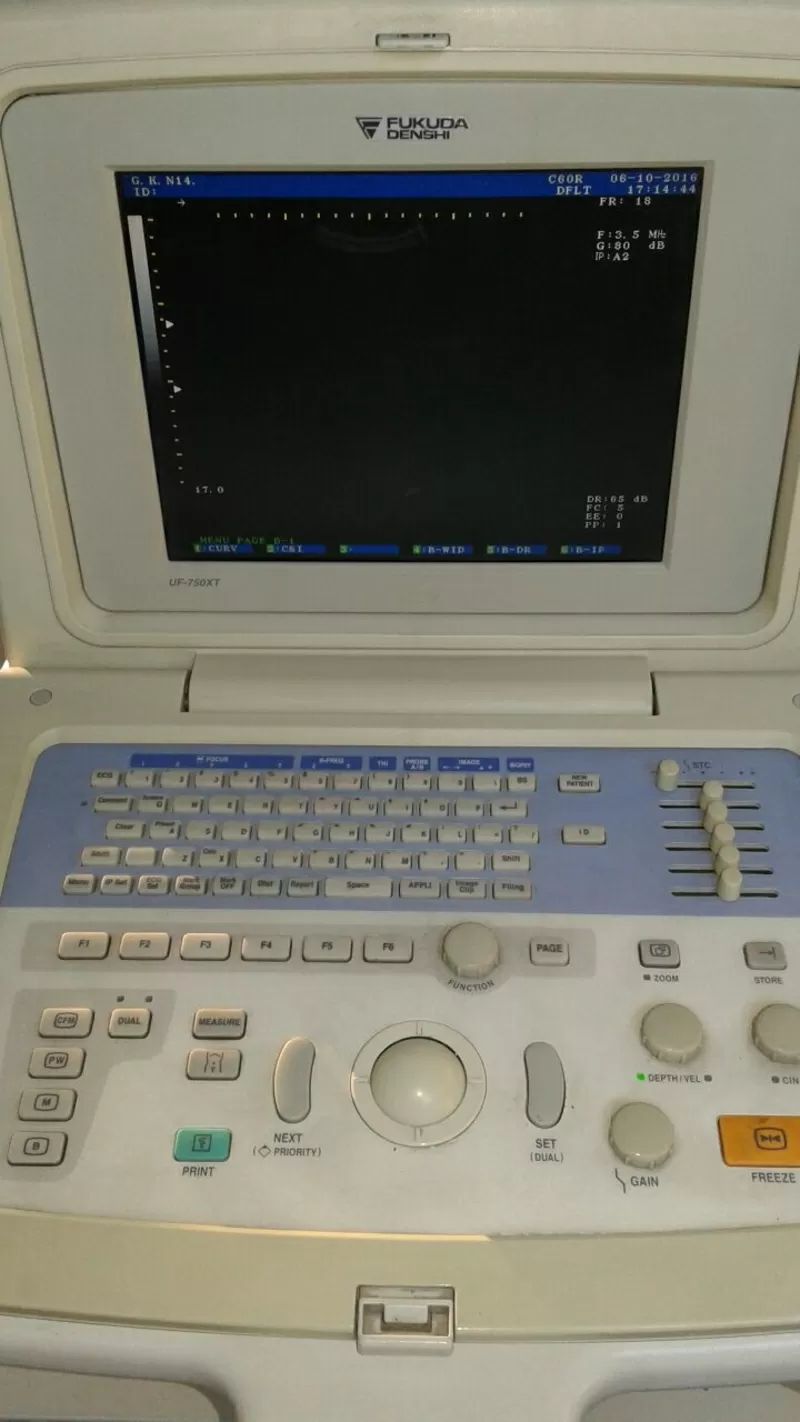 Диагностический портативный УЗИ сканер FUKUDA UF-750XT
