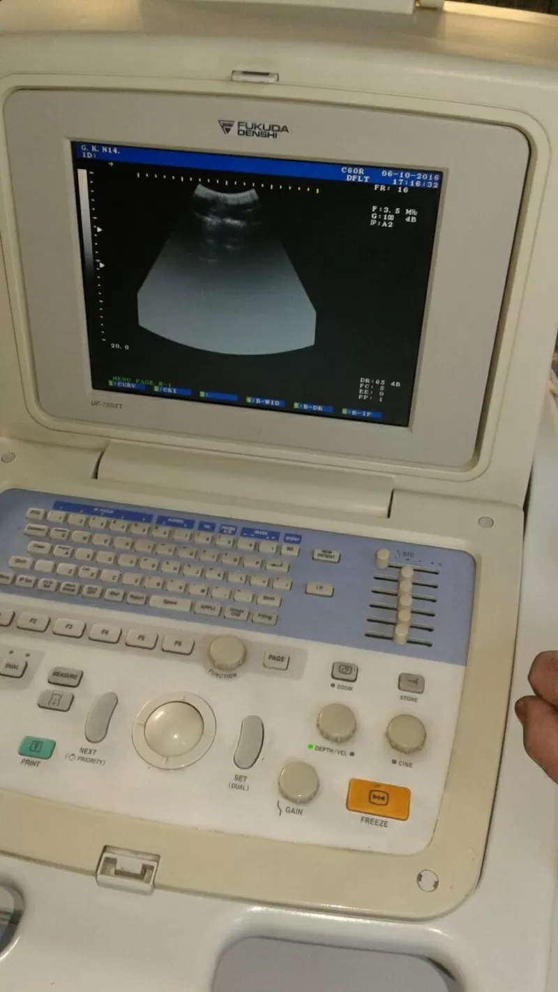 Диагностический портативный УЗИ сканер FUKUDA UF-750XT 5