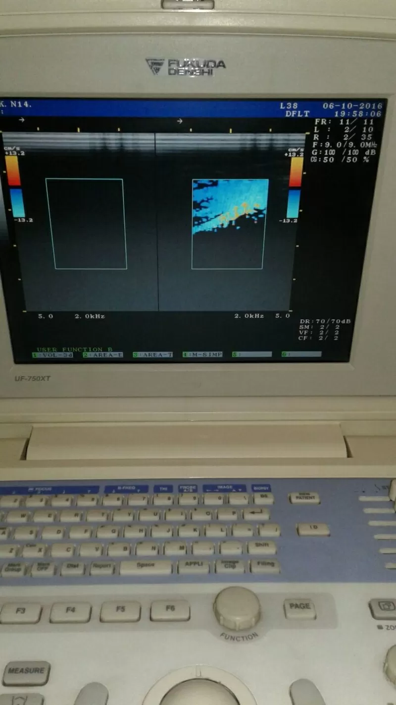 Диагностический портативный УЗИ сканер FUKUDA UF-750XT 7