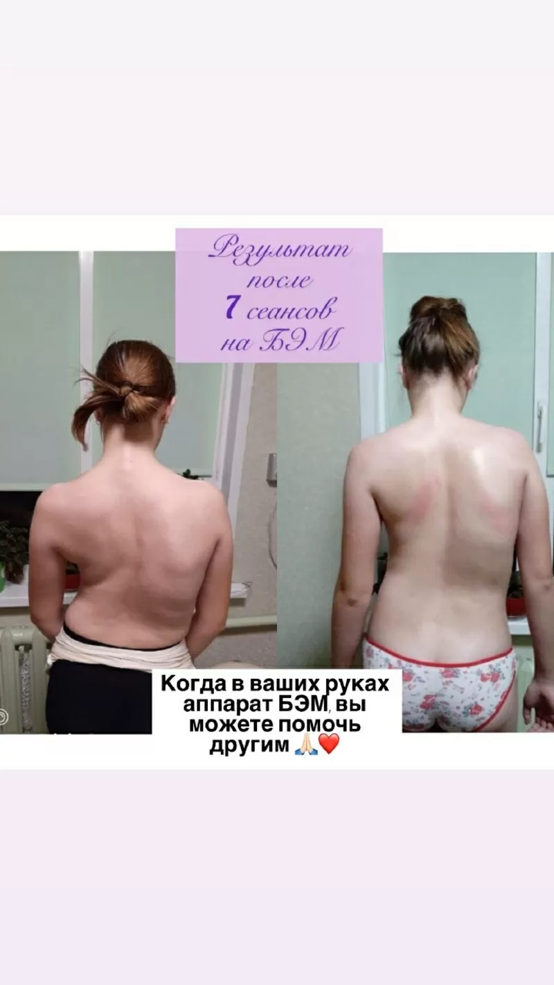 ОРГАНЫ ПОД ЗАЩИТОЙ БИОЭНЕРГИИ. 6